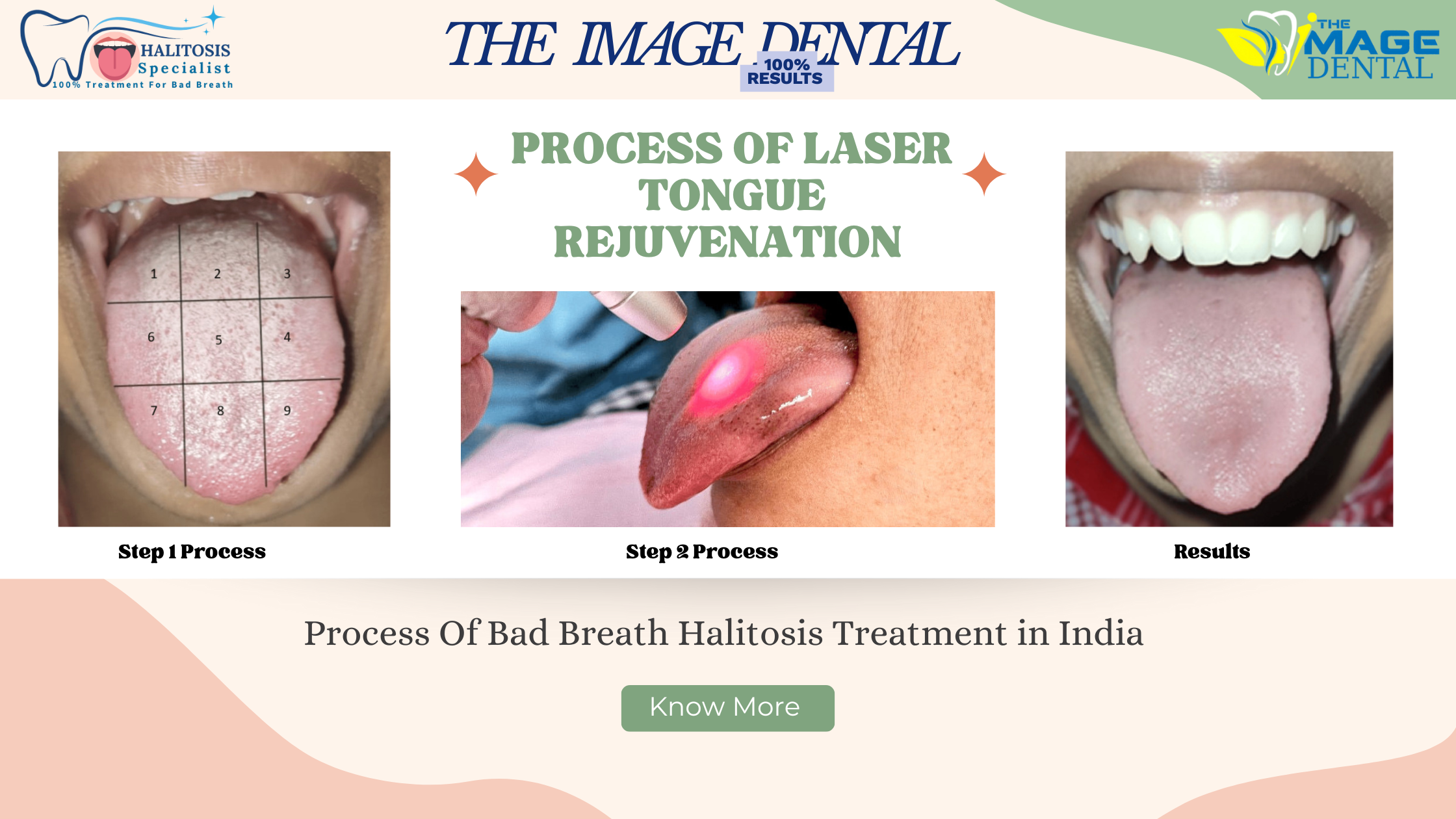 Bad breath (halitosis): Causes, diagnosis, and treatment